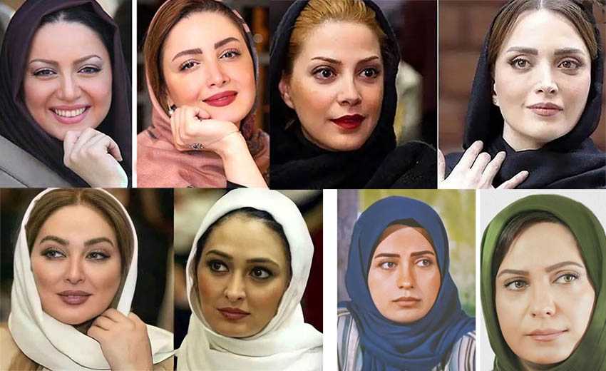عمل زیبایی پلک در بازیگران ایرانی حاشیه‌ساز شد!