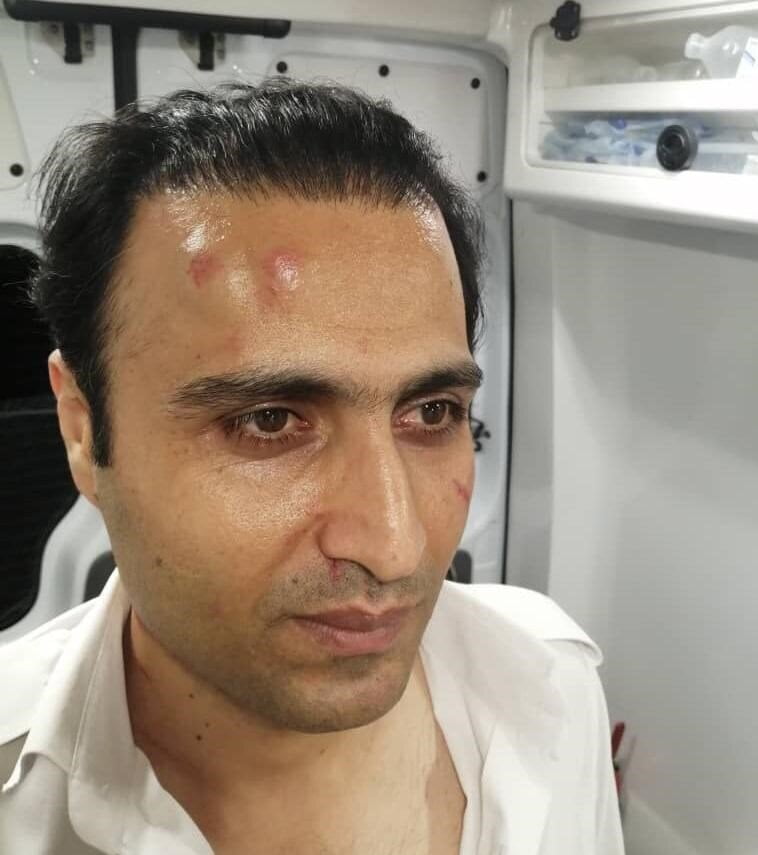 تکنسین اورژانس توسط اراذل مضروب شد/ عکس تکنسین اورژانس توسط اراذل مضروب شد/ عکس