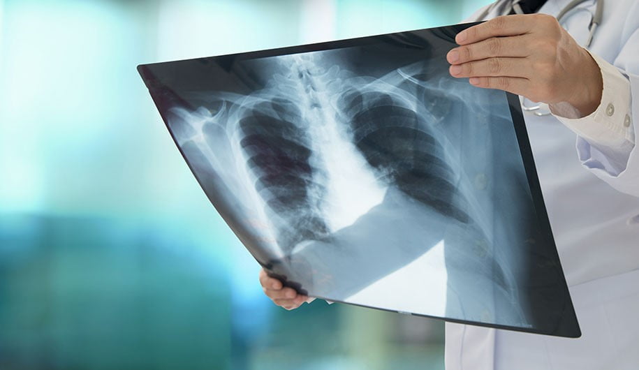 عفونت ریه، روشهای تشخیص و روشهای درمان