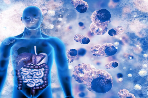 کمبود ویتامینی که باعث سرطان میشود کمبود ویتامینی که باعث سرطان میشود