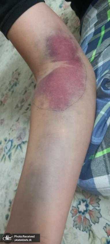 نامه سرگشاده جمعی از خانواده‌های کودکان هموفیلی به رییس‌جمهور: چرا داروی ارزان‌تر وارد نمی‌شود؟ اصراری که برای واردات داروی گران وجود دارد چه منفعتی برای چه کسی دارد؟ چرا با جان فرزندان بی‎گناه ما بازی می‌کنند؟