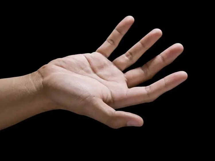 عجیب‌ترین جراحی زیبایی عمل خط کف دست!