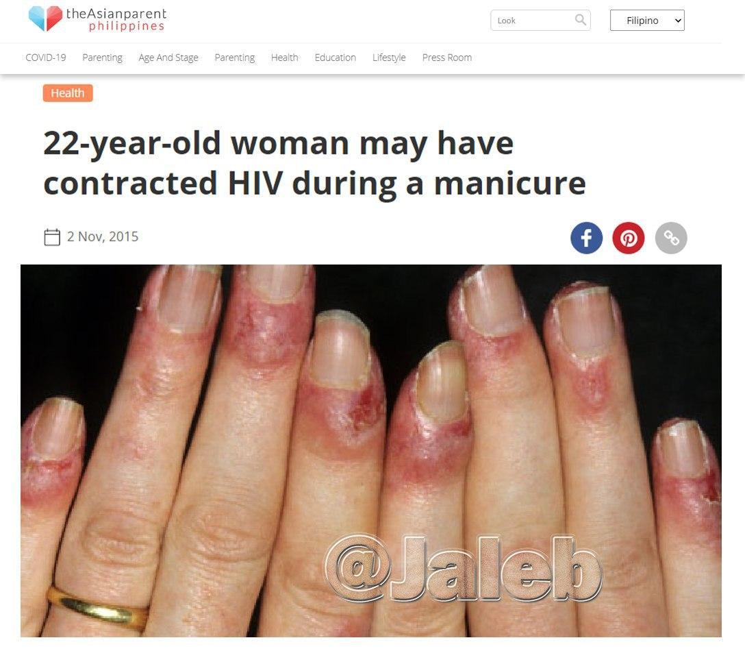دختر جوان بخاطر مانیکور کردن به ایدز مبتلا شد|خبر فوری