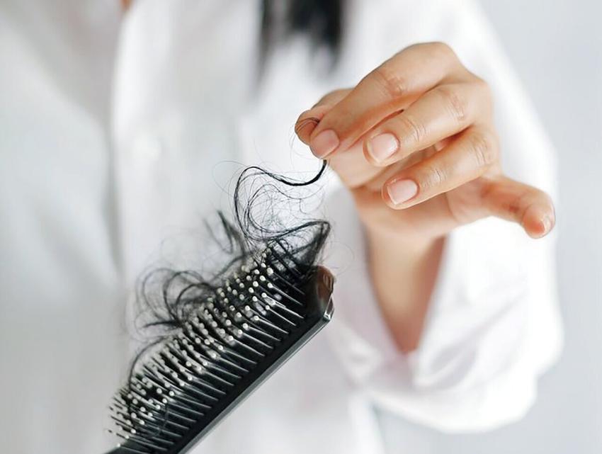 3 پیشنهاد برای جلوگیری از ریزش مو در زنان